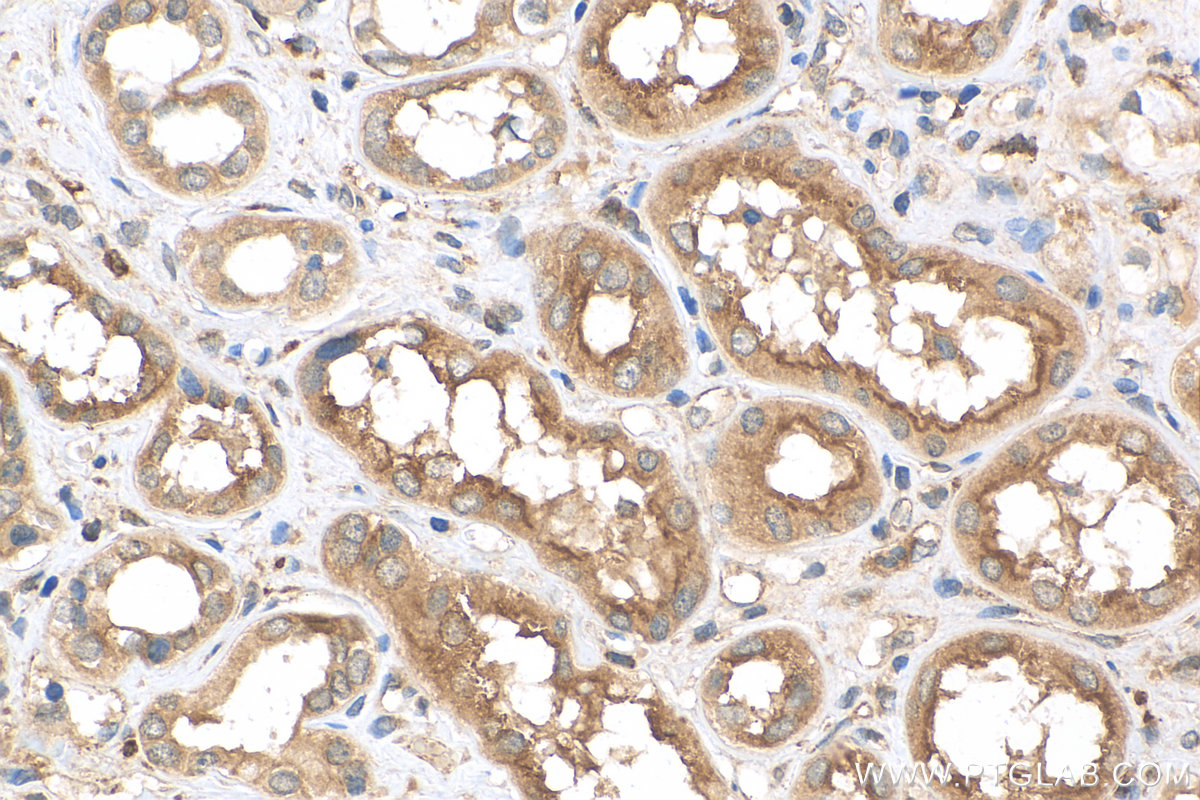 Oct4 Ihc OCT4/POU5F1 antibody (11263-1-AP) | Proteintech | 武汉三鹰生物技术有限公司