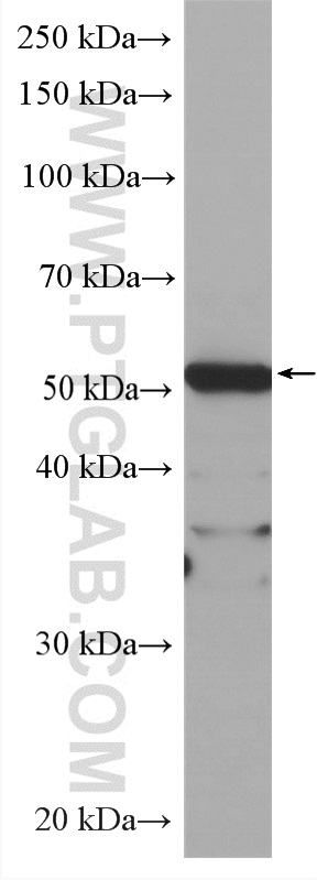 WB analysis of HEK-293 using HRP-60242