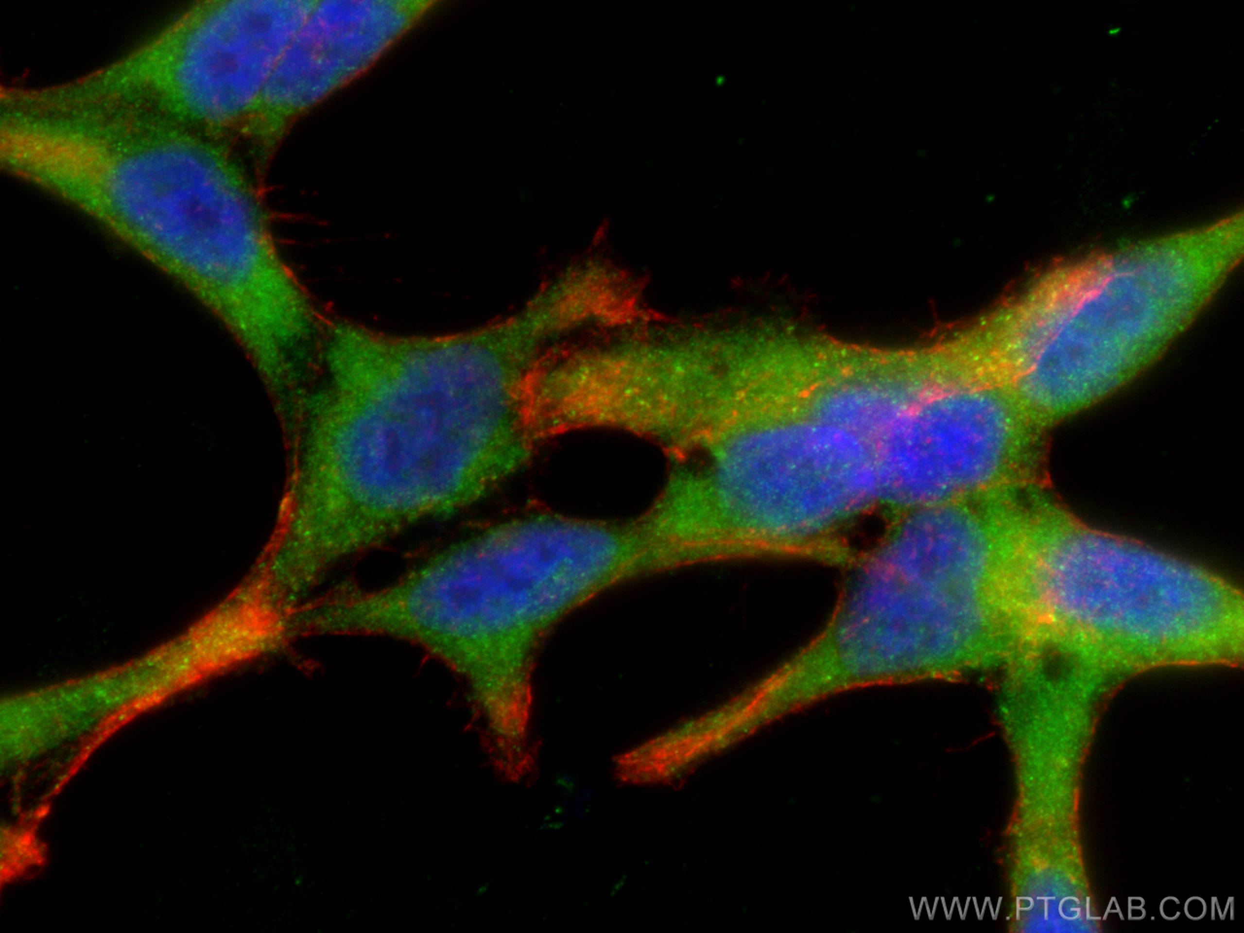 IF Staining of LNCaP using 28728-1-AP