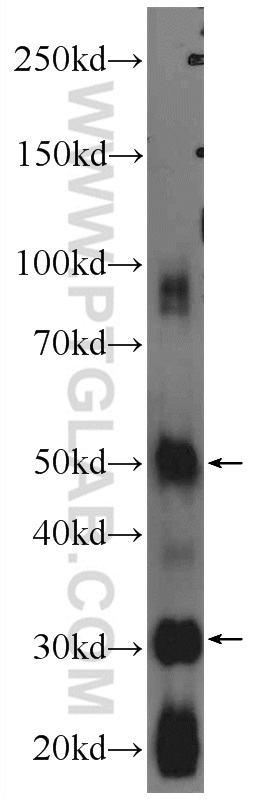 WB analysis of rat testis using 24736-1-AP