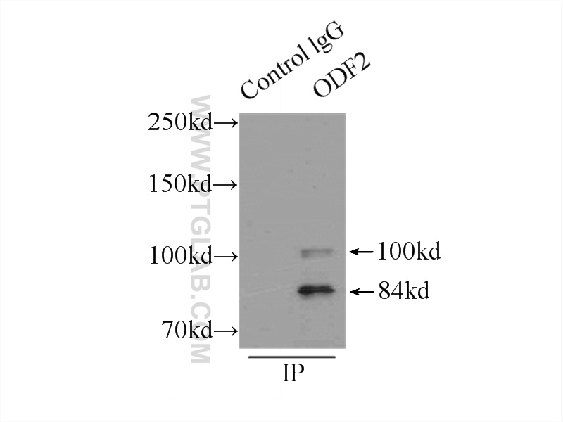 IP experiment of mouse testis using 12058-1-AP