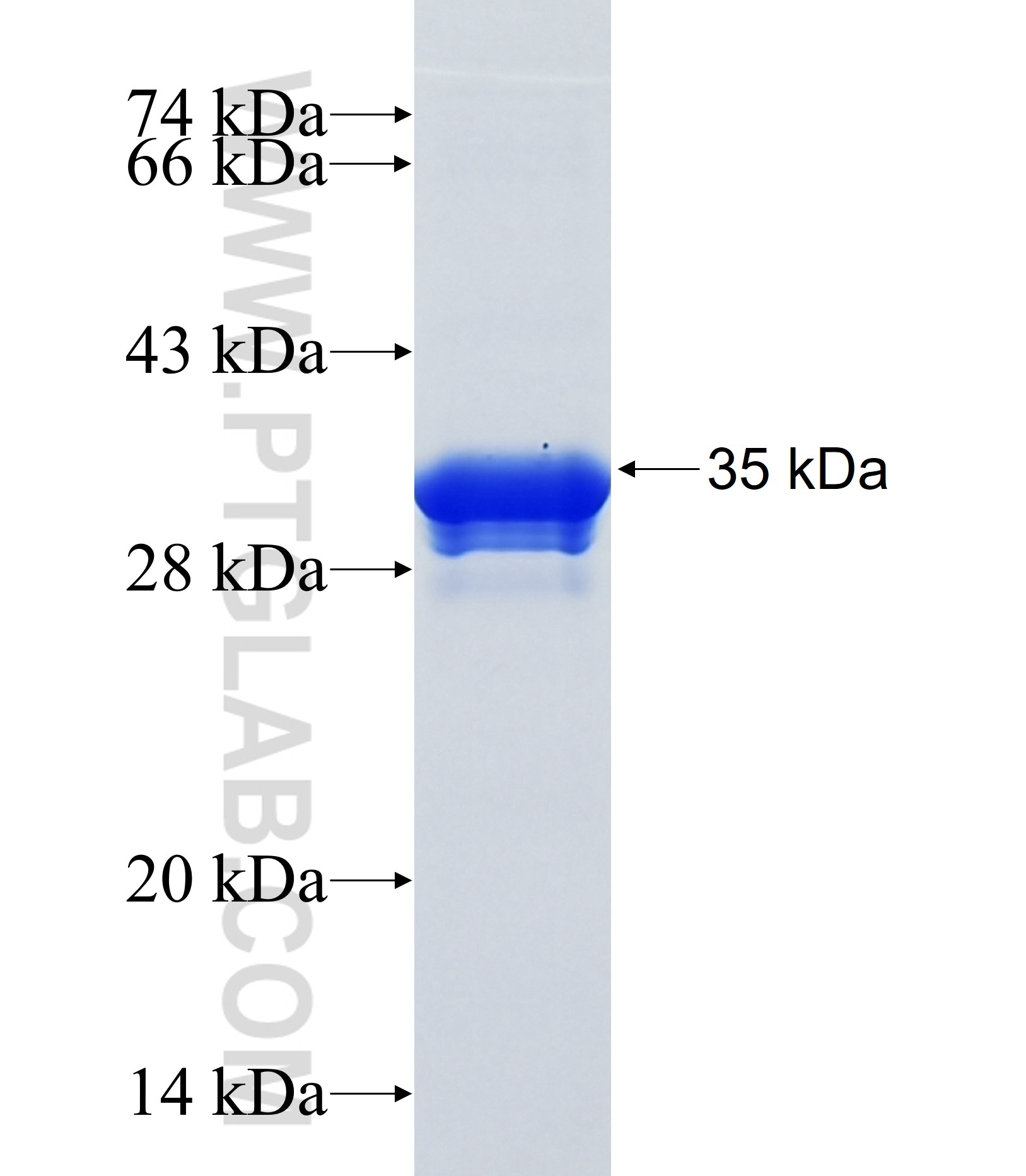 ODF4 fusion protein Ag36966 SDS-PAGE ODF4 fusion protein Ag36966 SDS-PAGE