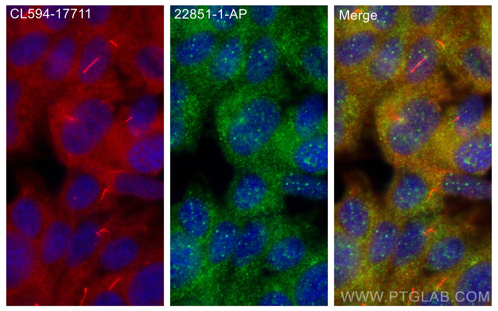 IF Staining of hTERT-RPE1 using 22851-1-AP