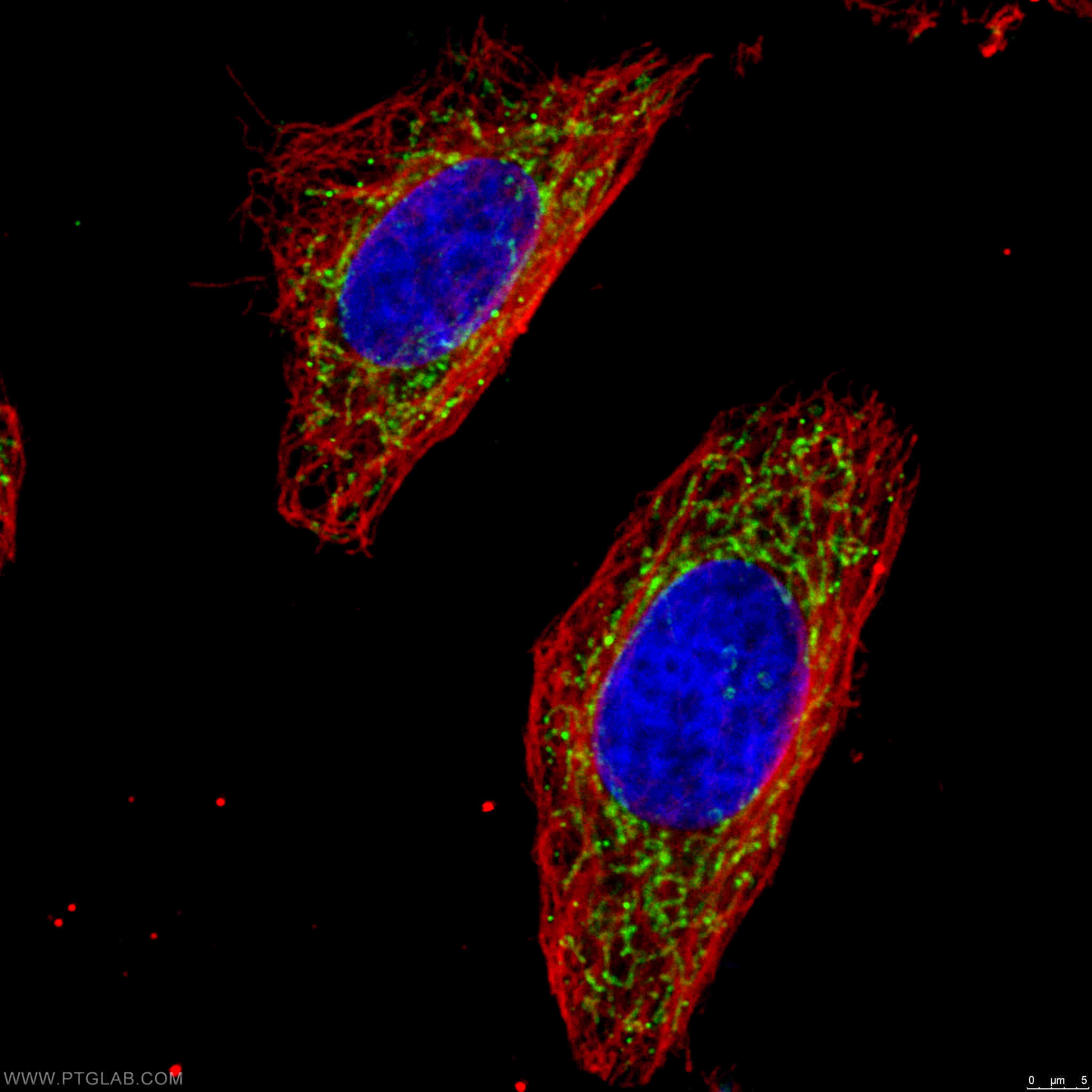 IF Staining of HeLa using 15212-1-AP