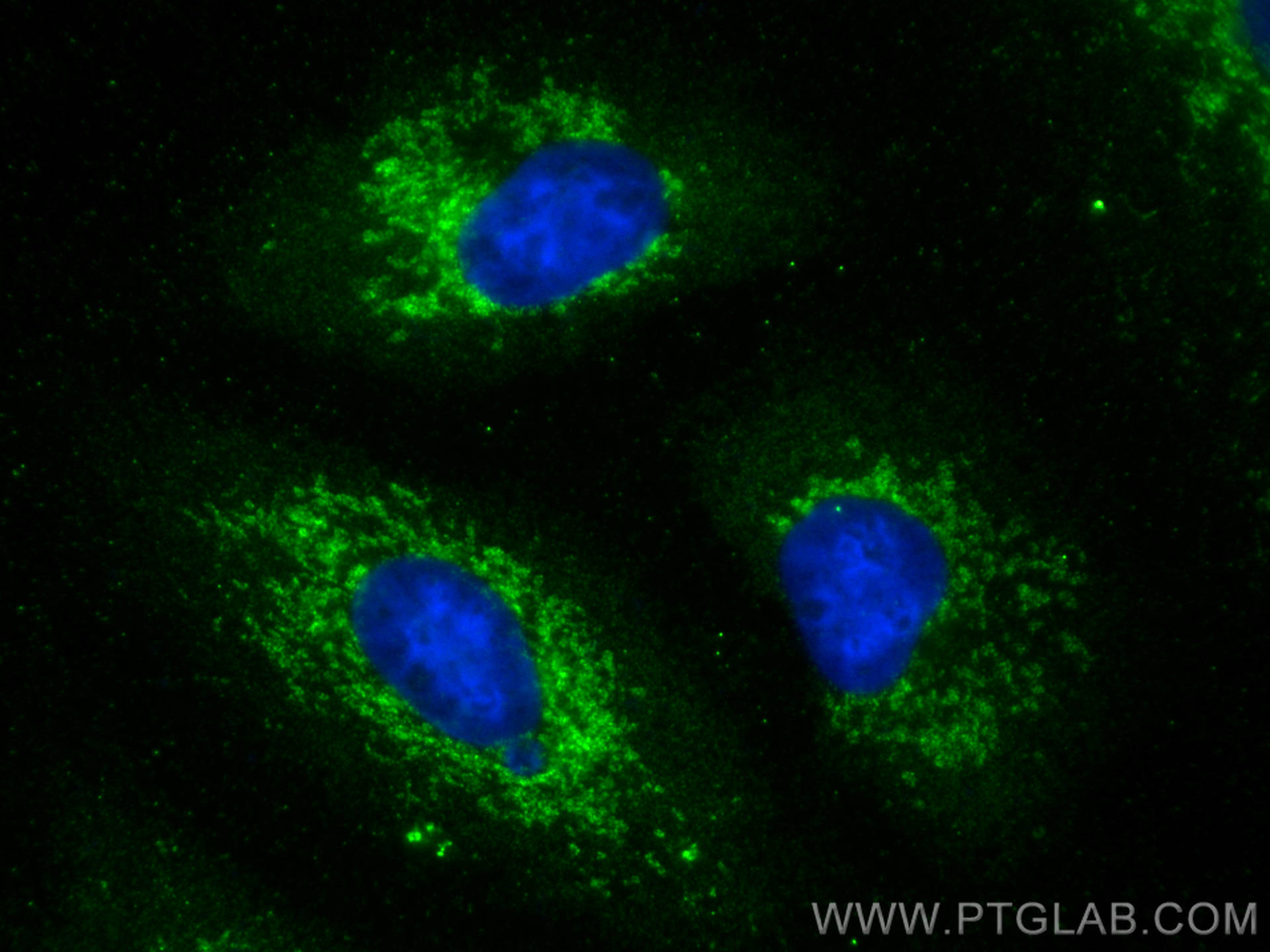 IF Staining of A549 using 15212-1-AP