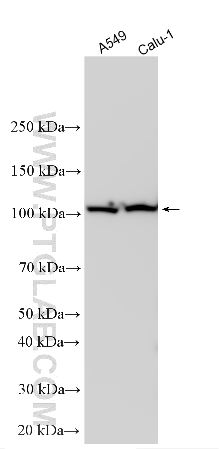 Various lysates were subjected to SDS PAGE followed by western blot with 15212-1-AP (OGDH antibody) at dilution of 1:30000 incubated at room temperature for 1.5 hours. WB analysis using 15212-1-AP