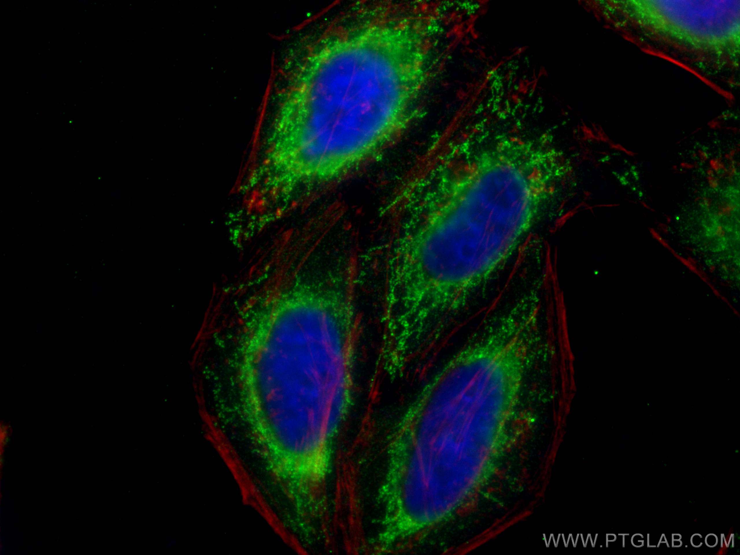 IF Staining of HepG2 using 66285-1-Ig