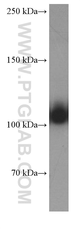WB analysis of human heart using 66285-1-Ig (same clone as 66285-1-PBS)