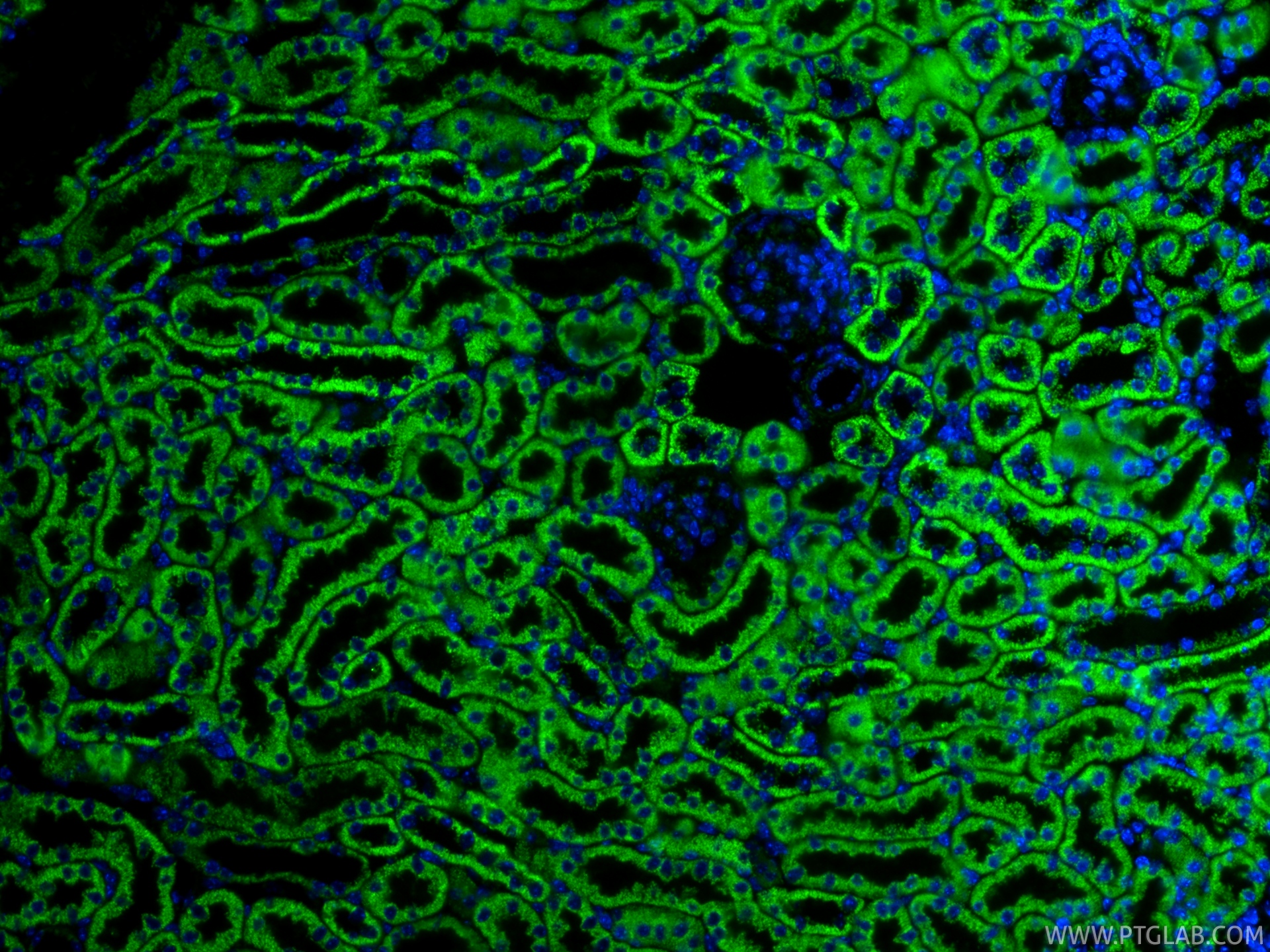 IF Staining of mouse kidney using 82773-1-RR