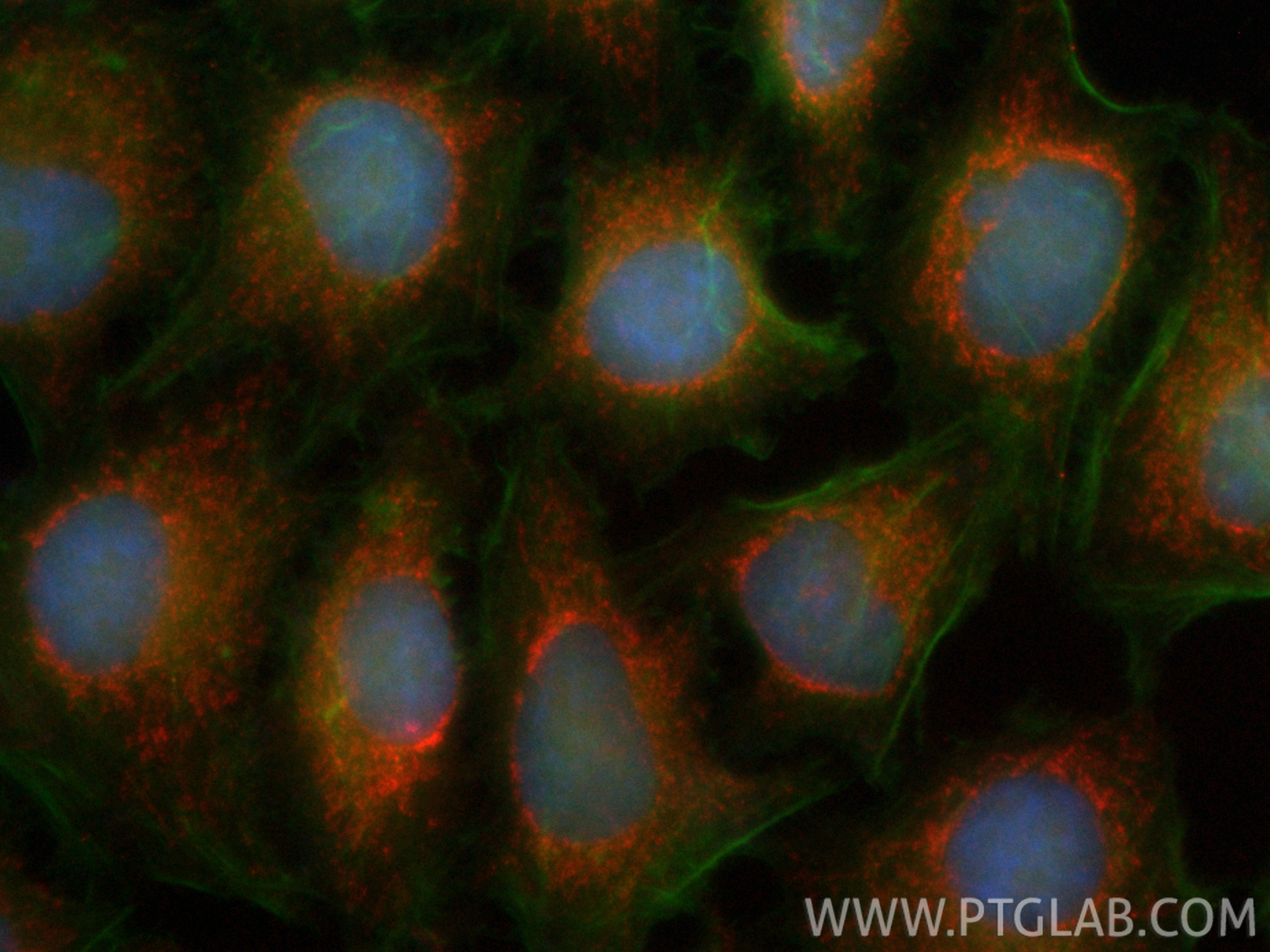 IF Staining of HepG2 using CL594-66285 IF Staining of HepG2 using CL594-66285