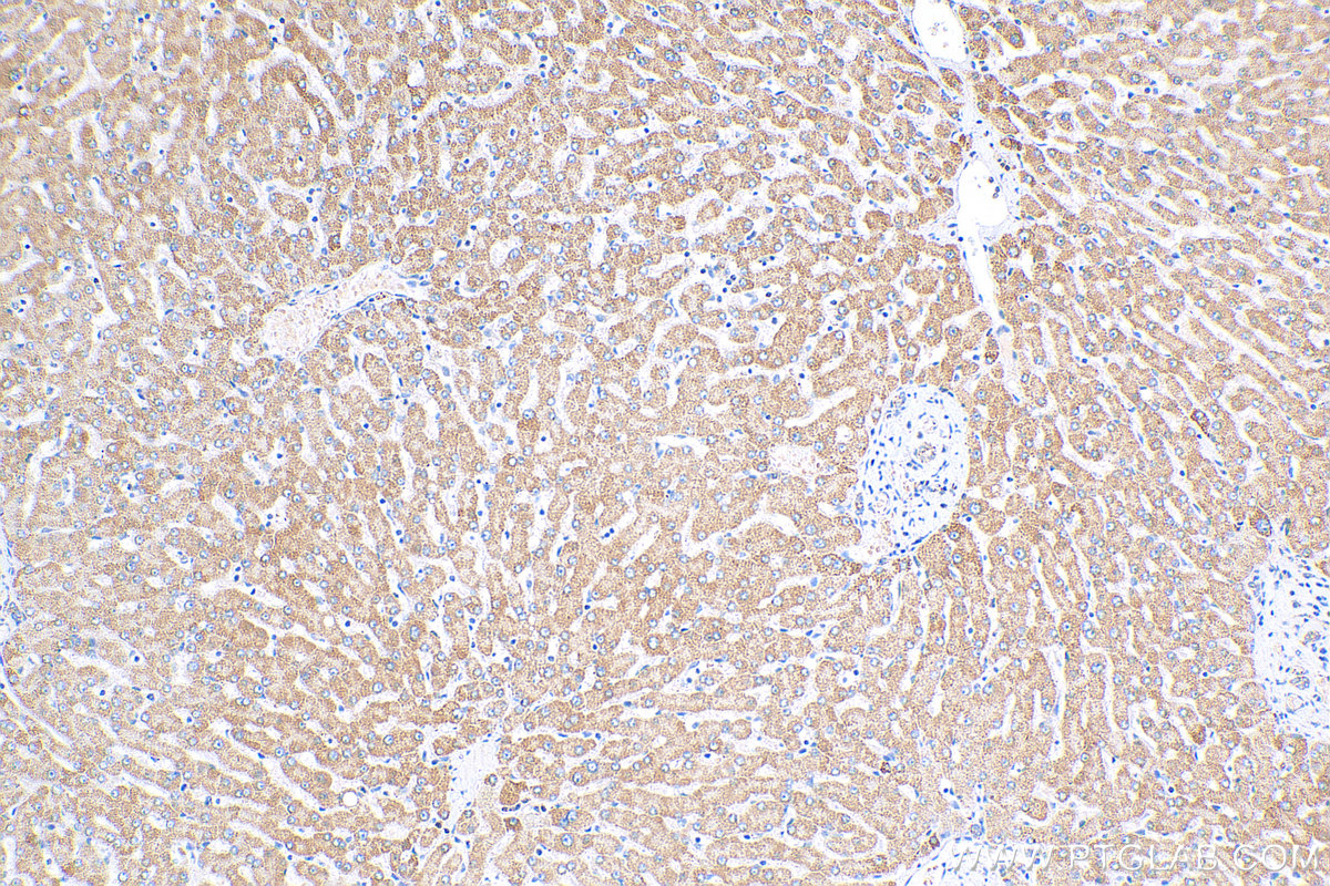 IHC staining of human liver using 17110-1-AP