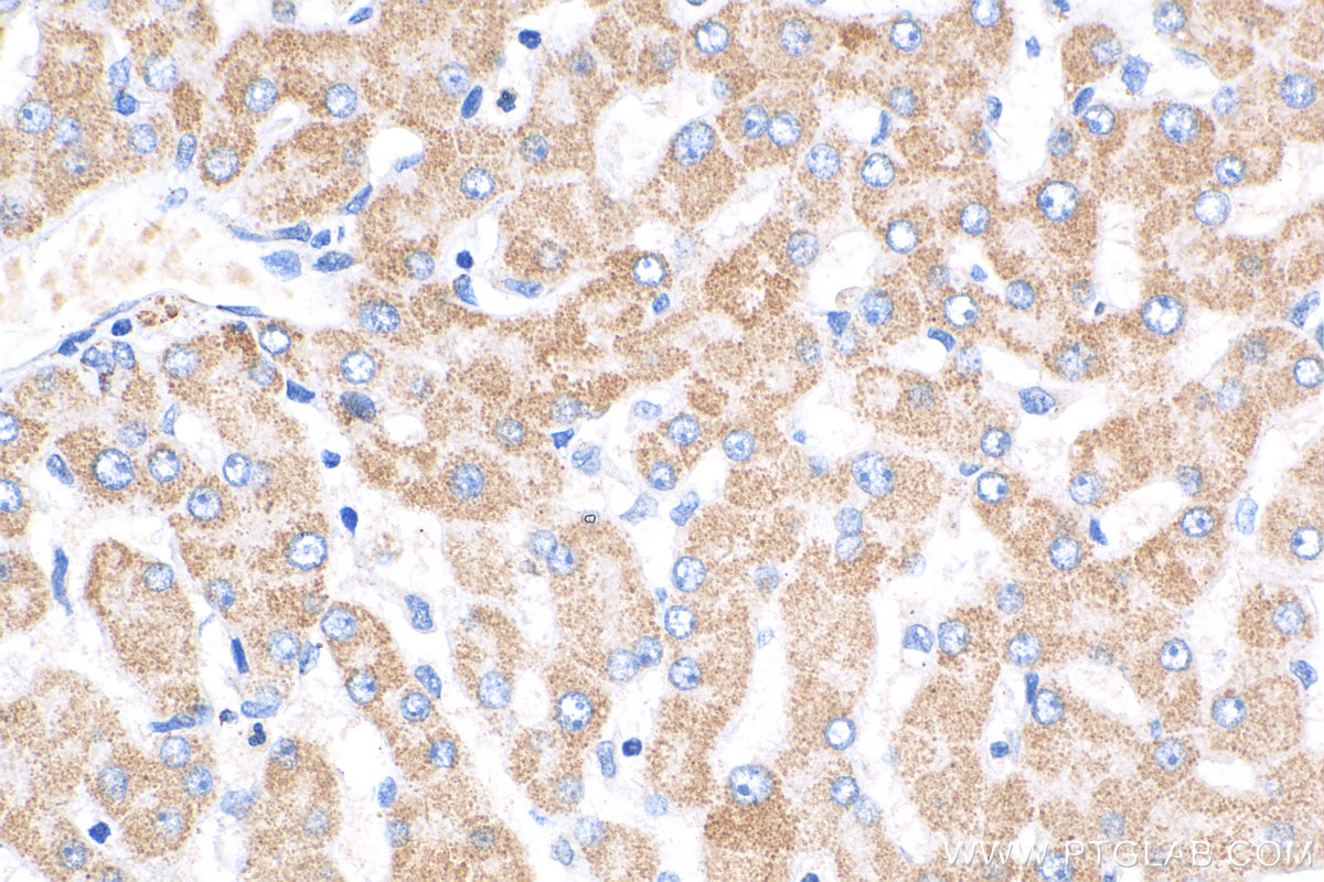 IHC staining of human liver using 17110-1-AP