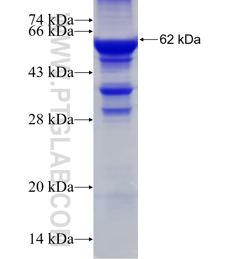 OGDHL fusion protein Ag10794 SDS-PAGE