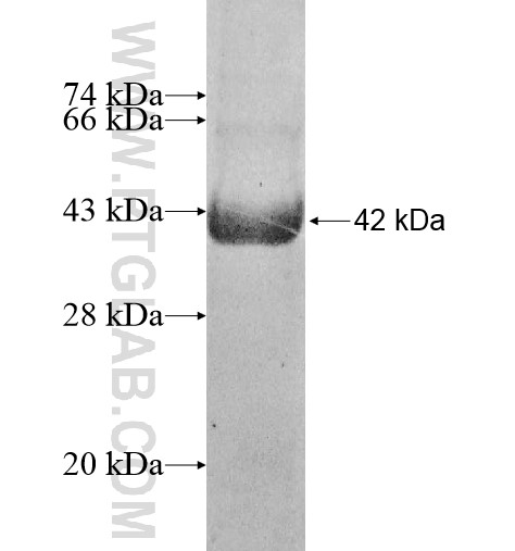 OGDHL fusion protein Ag10841 SDS-PAGE