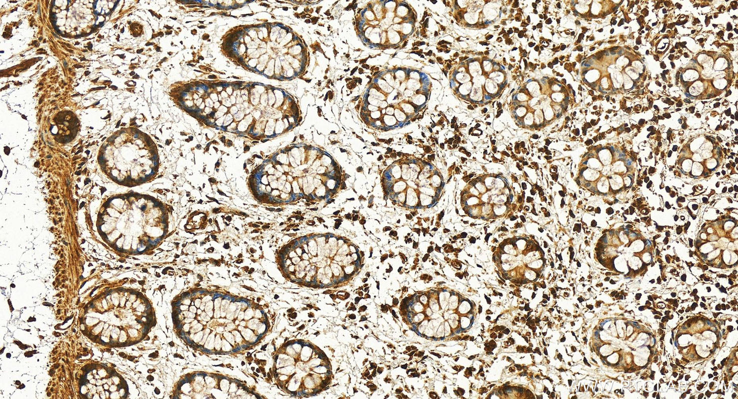Immunohistochemical analysis of paraffin-embedded human colon tissue slide using 30800-1-AP (OGFOD1 antibody) at dilution of 1:200 (under 20x lens). Heat mediated antigen retrieval with Tris-EDTA buffer (pH 9.0). IHC staining of human colon using 30800-1-AP