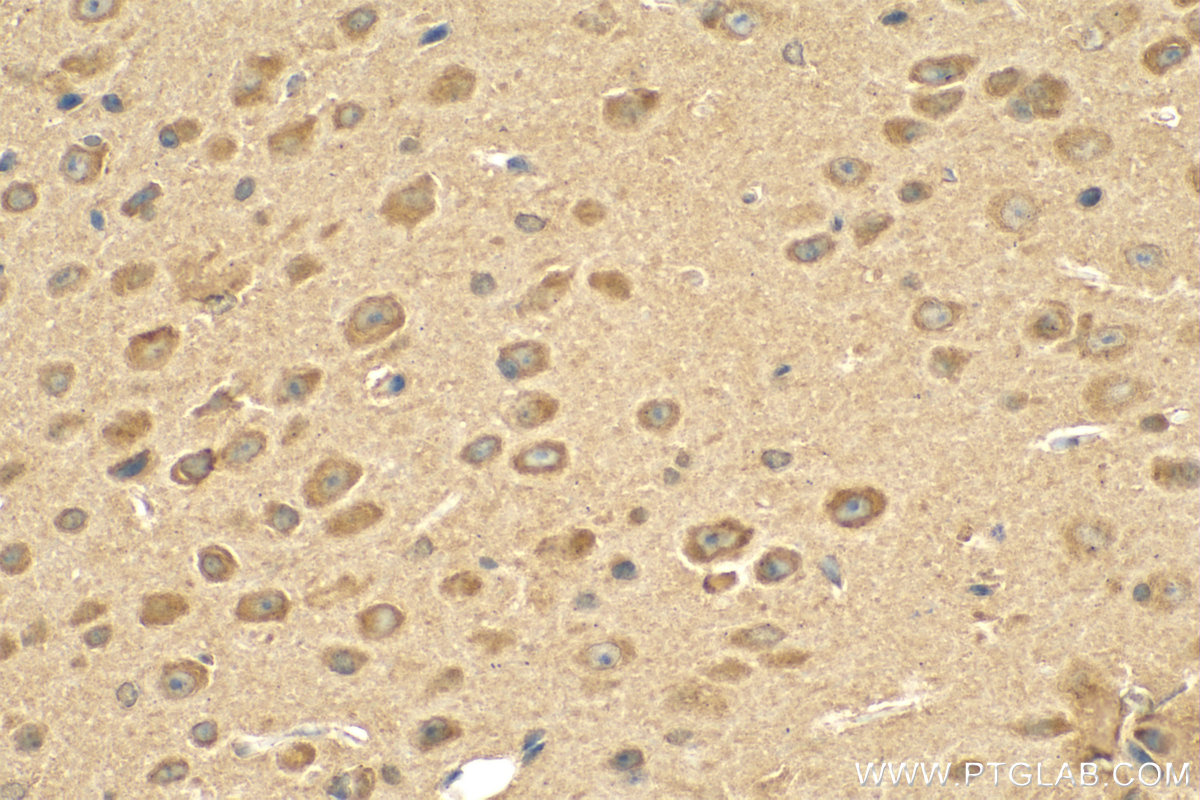 IHC staining of mouse brain using 21590-1-AP