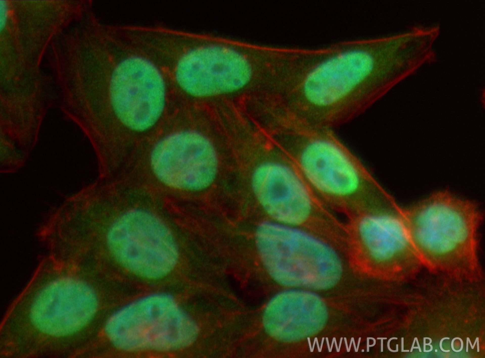 IF Staining of HepG2 using 11177-1-AP