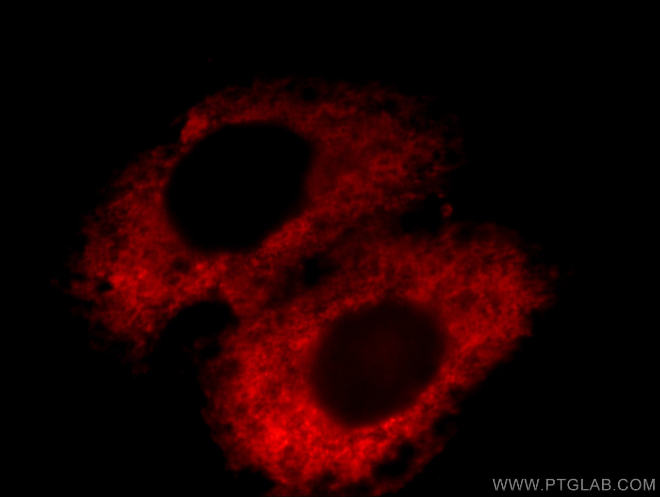 IF Staining of HepG2 using 12755-1-AP