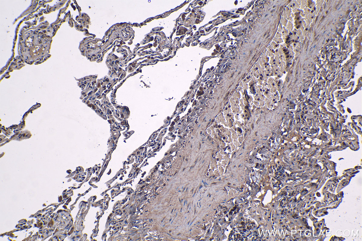 IHC staining of human lung using 12755-1-AP IHC staining of human lung using 12755-1-AP