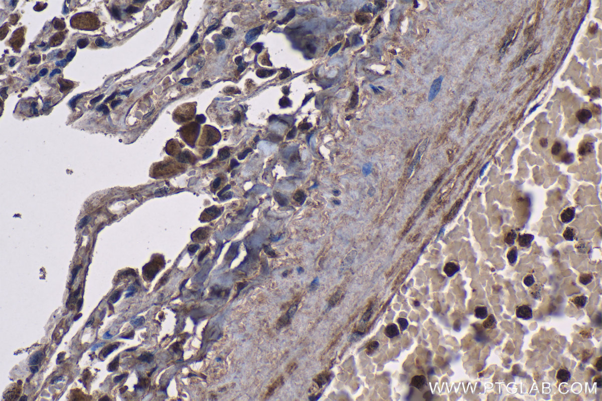IHC staining of human lung using 12755-1-AP IHC staining of human lung using 12755-1-AP