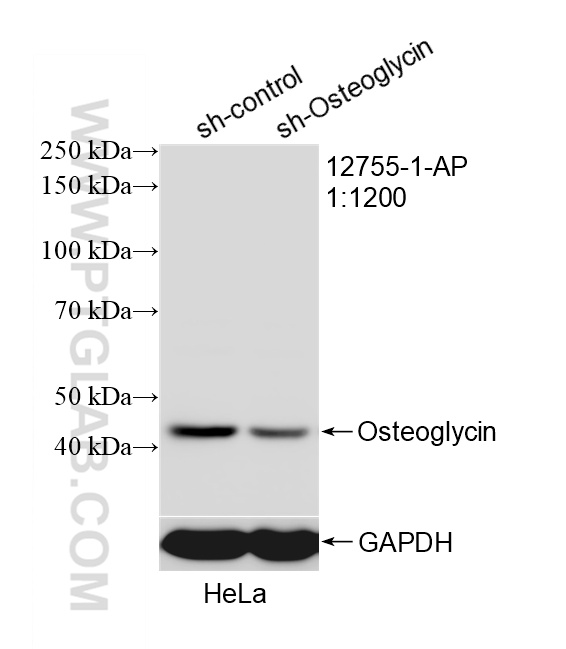 WB analysis of HeLa using 12755-1-AP WB analysis of HeLa using 12755-1-AP