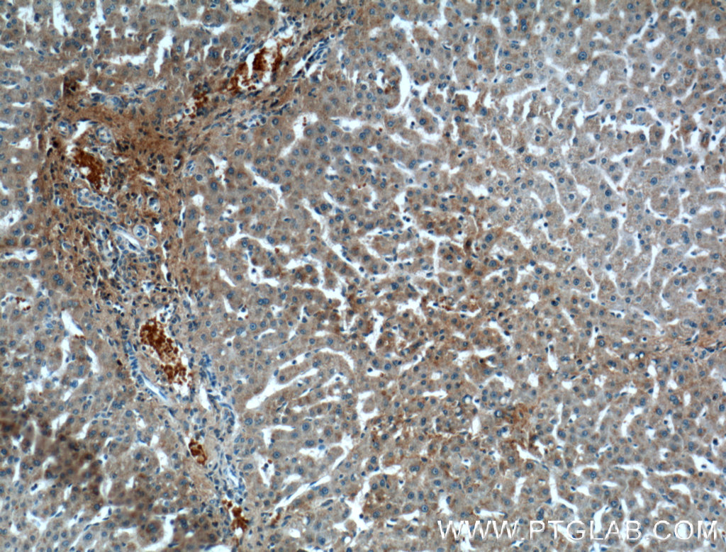 IHC staining of human liver using 66382-1-Ig (same clone as 66382-1-PBS)