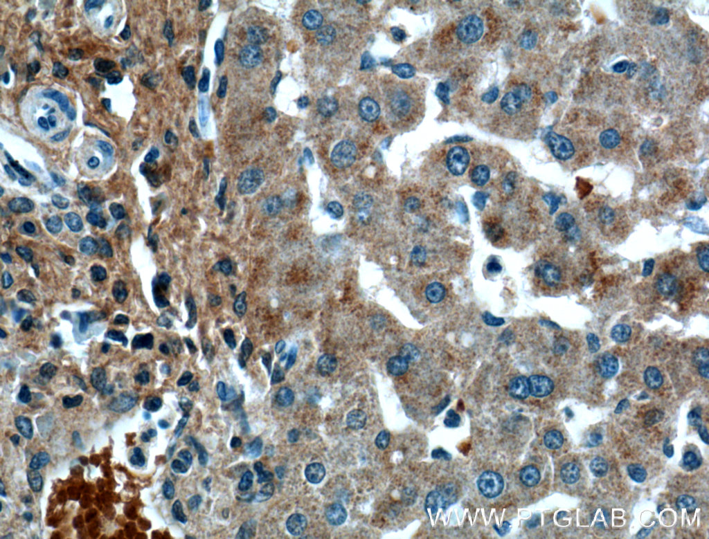 IHC staining of human liver using 66382-1-Ig (same clone as 66382-1-PBS)