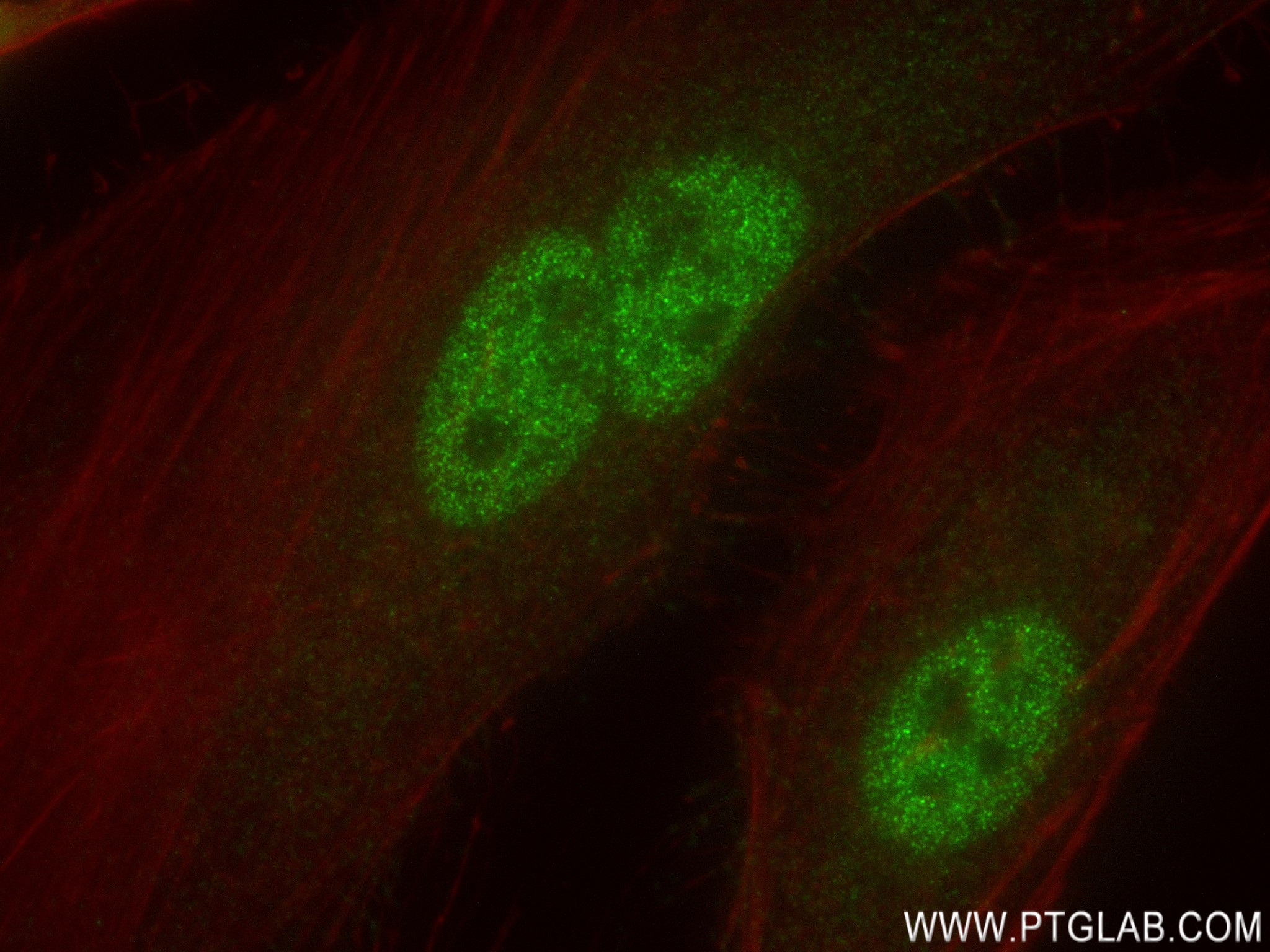 IF Staining of HeLa using 83113-1-RR (same clone as 83113-1-PBS)