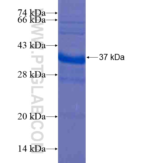 OIT3 fusion protein Ag20421 SDS-PAGE OIT3 fusion protein Ag20421 SDS-PAGE