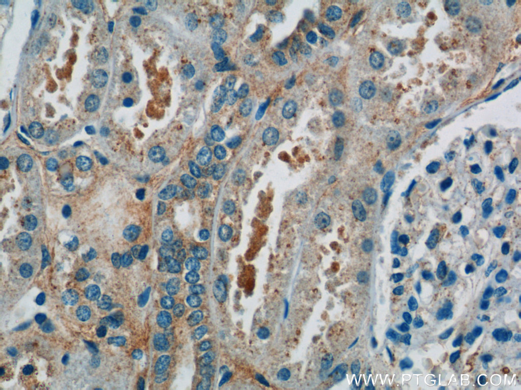 IHC staining of human kidney using 19842-1-AP