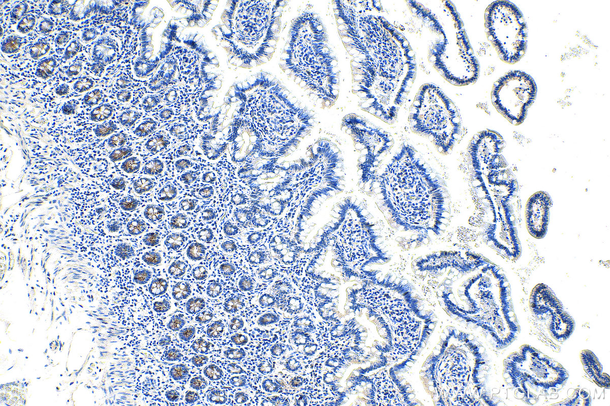 IHC staining of human small intestine using 28432-1-AP