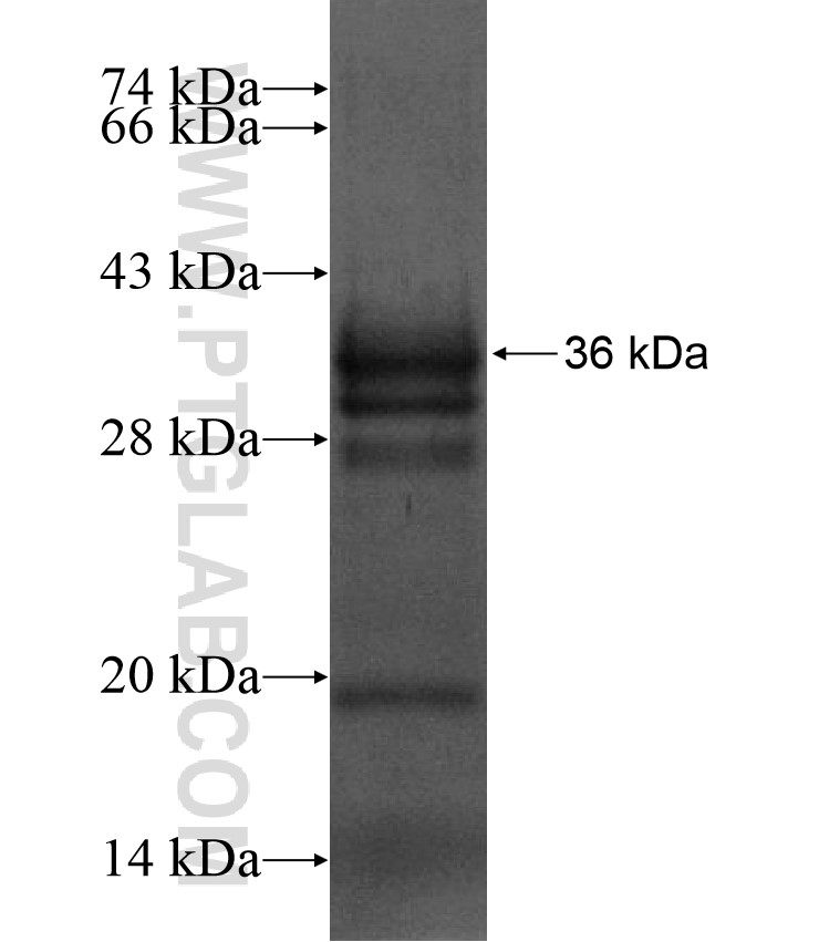 OLIG1 fusion protein Ag17191 SDS-PAGE OLIG1 fusion protein Ag17191 SDS-PAGE