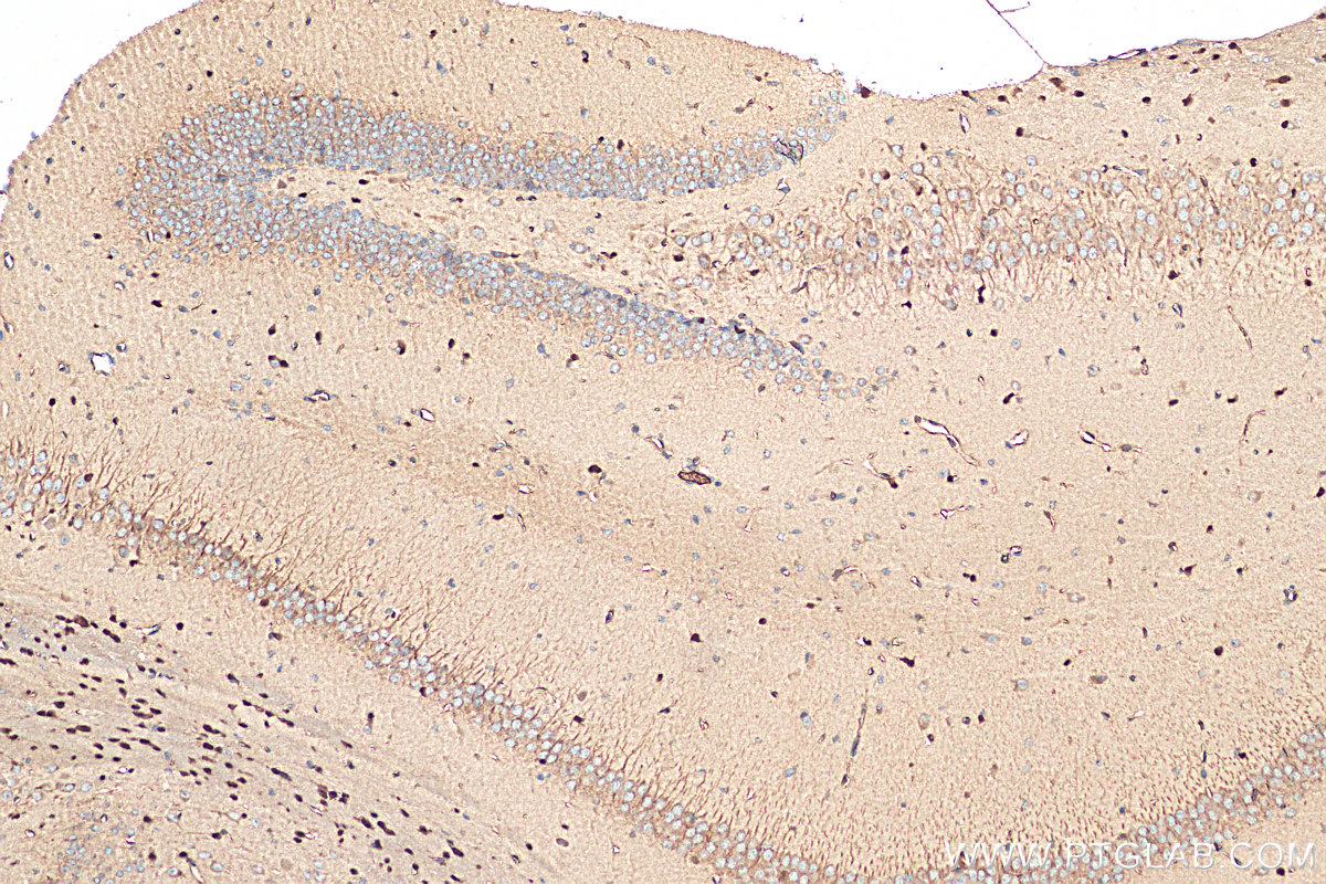 IHC staining of mouse brain using 13999-1-AP