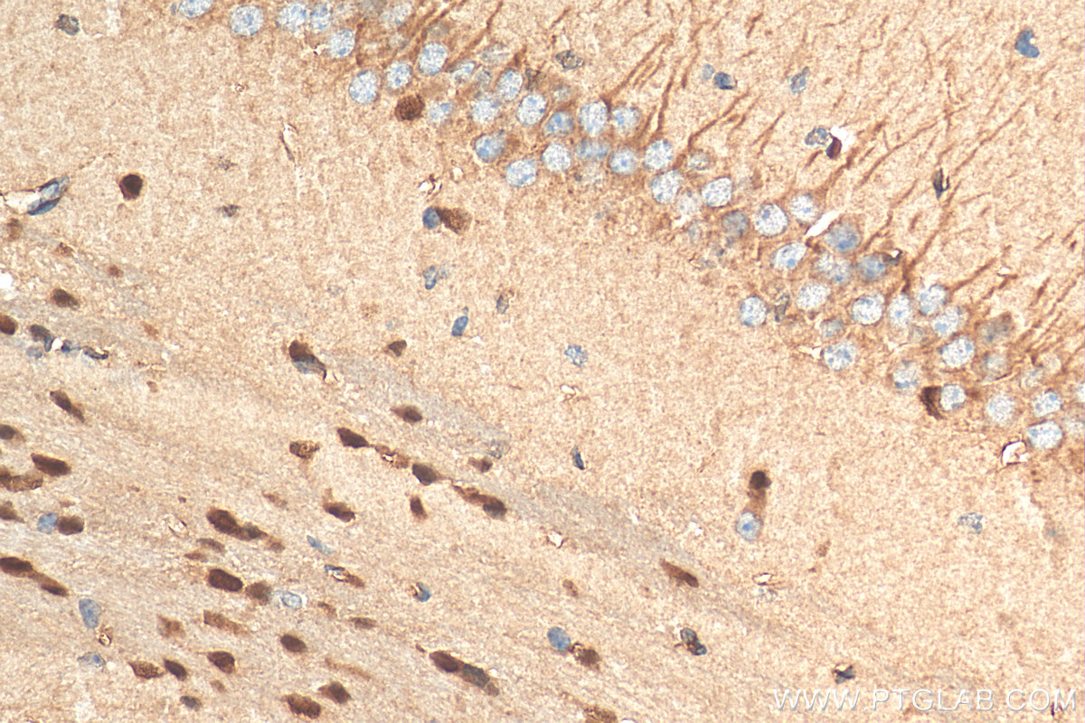 OLIG2 Antibody 13999 1 AP Proteintech olig2-antibody-13999-1-ap-proteintech