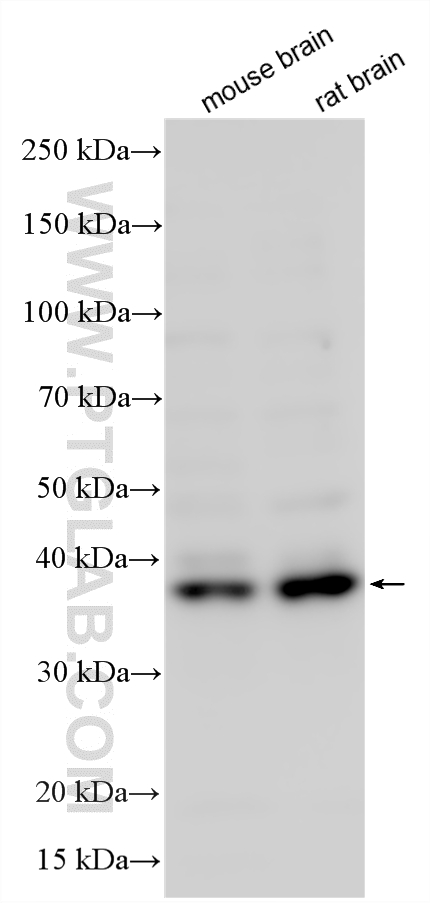 Various lysates were subjected to SDS PAGE followed by western blot with 13999-1-AP (OLIG2 antibody) at dilution of 1:3000 incubated at room temperature for 1.5 hours. WB analysis using 13999-1-AP