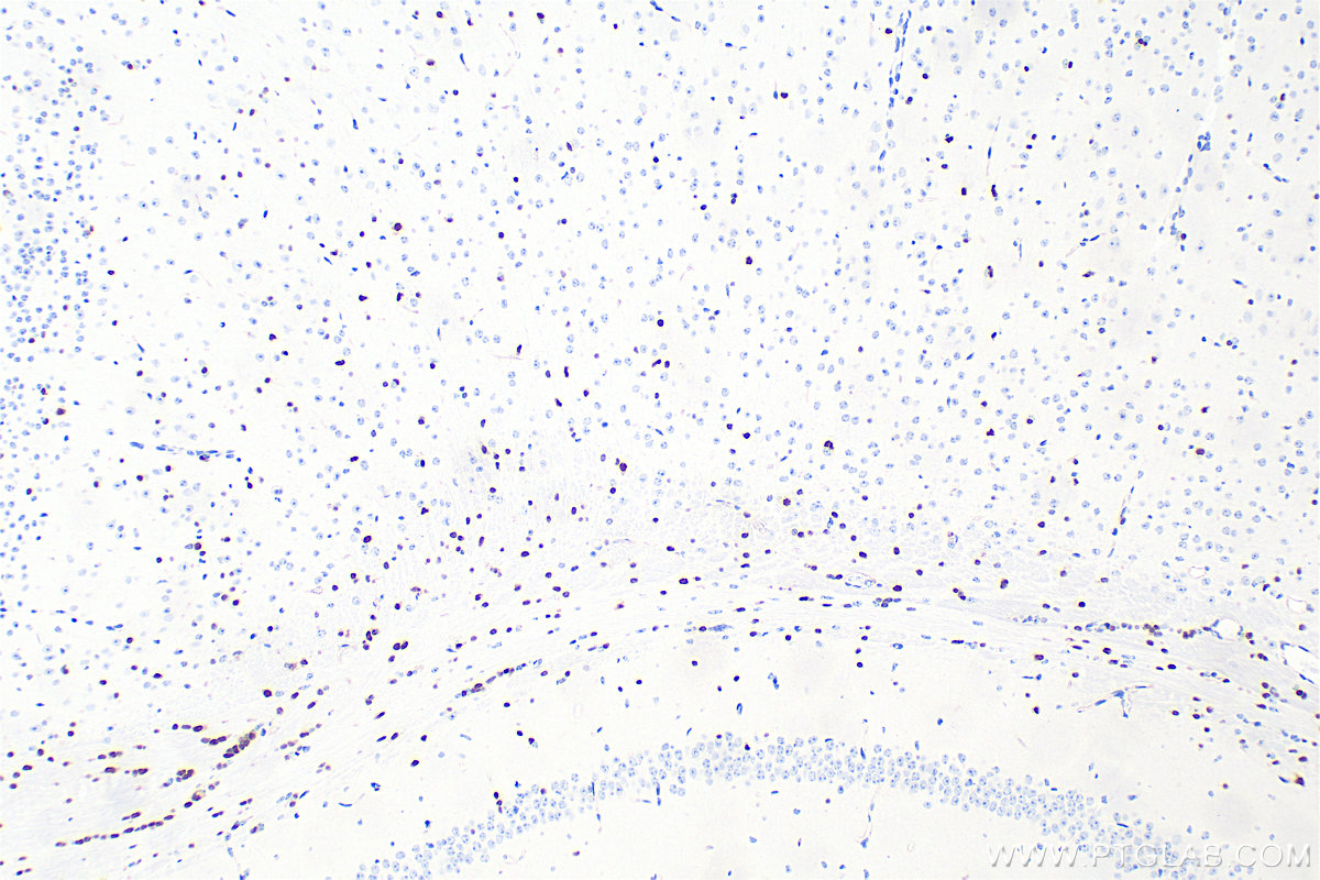 IHC staining of mouse brain using 82806-7-RR IHC staining of mouse brain using 82806-7-RR
