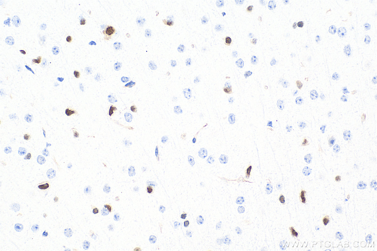 IHC staining of mouse brain using 82806-7-RR IHC staining of mouse brain using 82806-7-RR