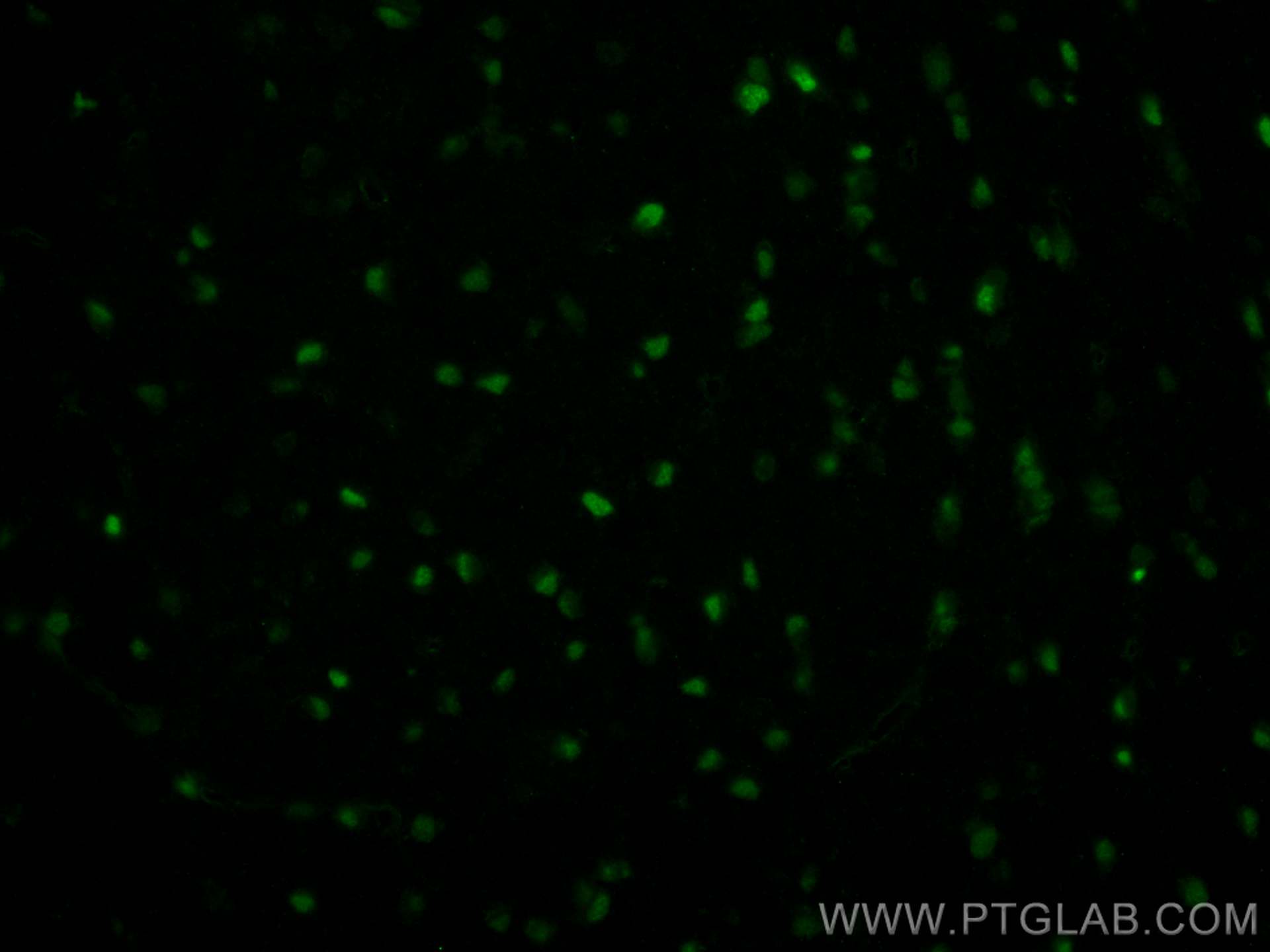 Immunofluorescent analysis of (4% PFA) fixed paraffin-embedded rat brain tissue using CoraLite® Plus 488 OLIG2 antibody (CL488-13999) at dilution of 1:200. Heat mediated antigen retrieval with Tris-EDTA buffer (pH 9.0). IF Staining of rat brain using CL488-13999