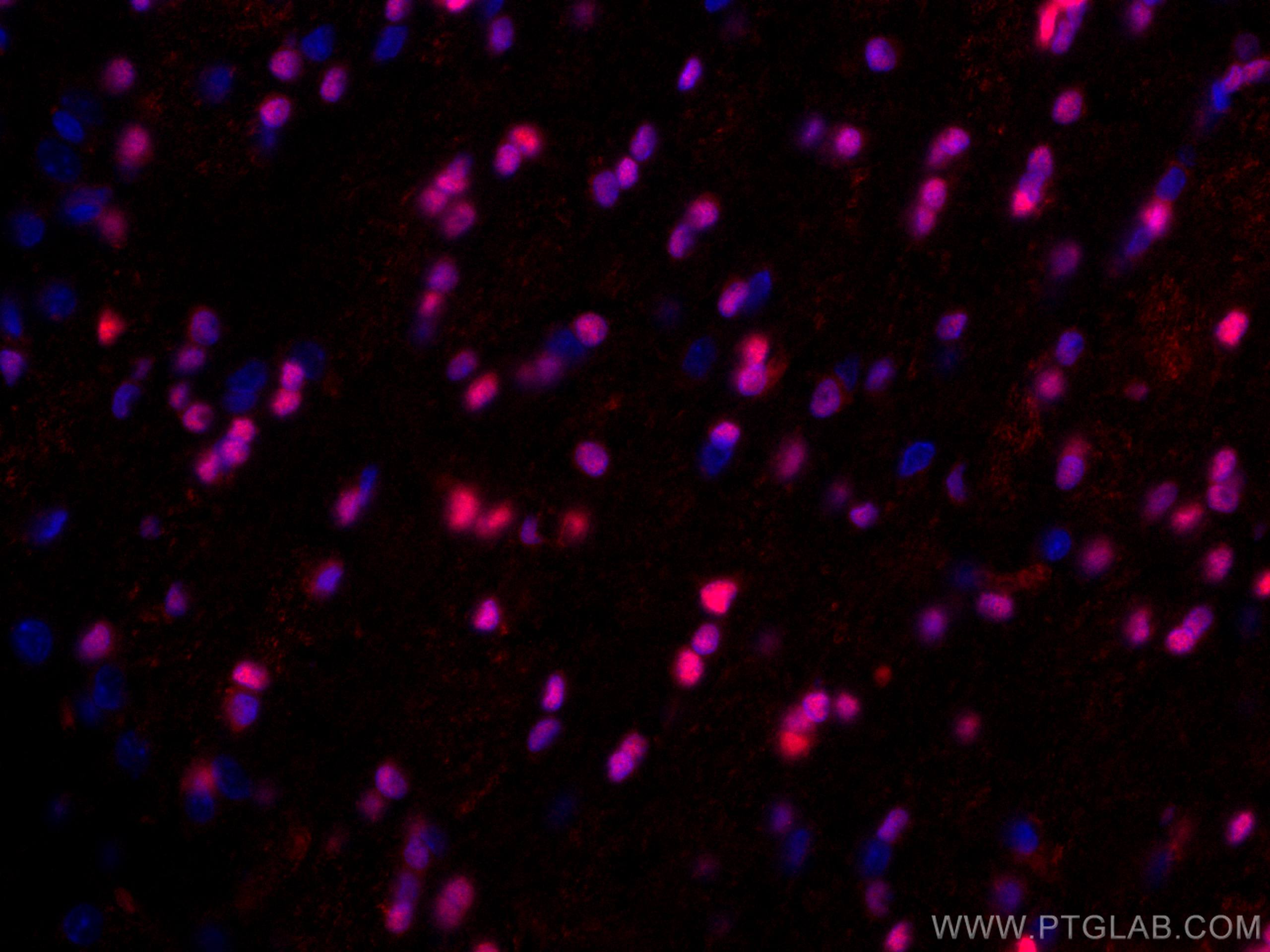 IF Staining of rat brain using CL594-13999