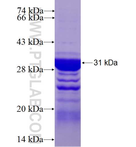 OLIG3 fusion protein Ag10046 SDS-PAGE OLIG3 fusion protein Ag10046 SDS-PAGE