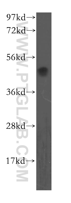 OLR1 Polyclonal antibody
