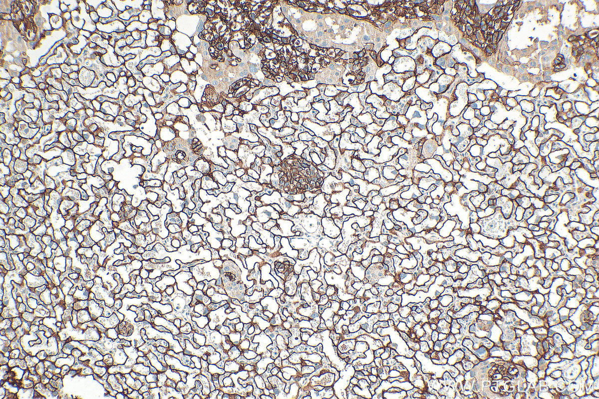 IHC staining of mouse placenta using 32685-1-AP IHC staining of mouse placenta using 32685-1-AP