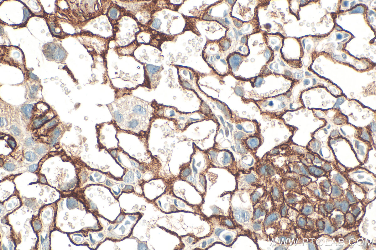 IHC staining of mouse placenta using 32685-1-AP IHC staining of mouse placenta using 32685-1-AP