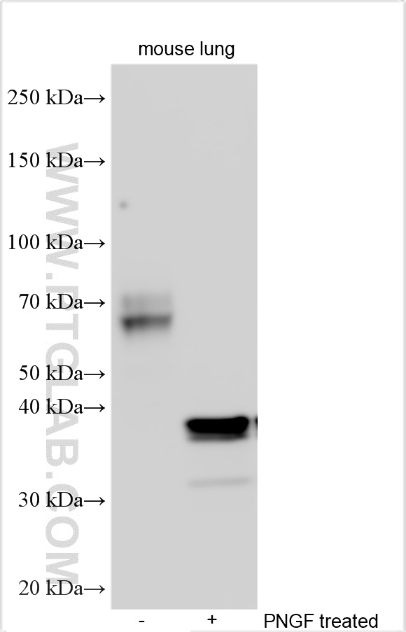 WB analysis using 32685-1-AP WB analysis using 32685-1-AP