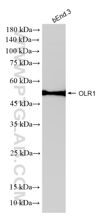 WB analysis using 86194-3-RR WB analysis using 86194-3-RR