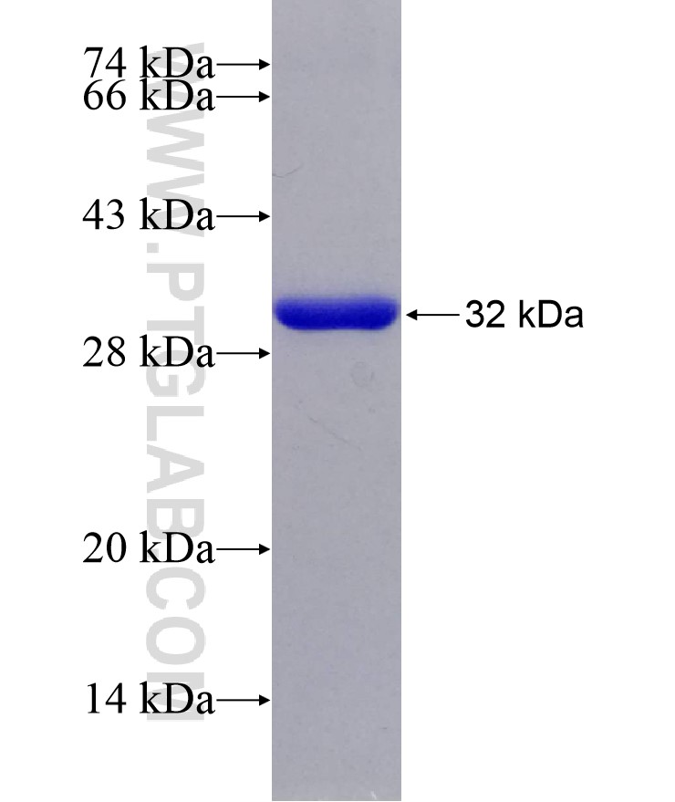 OMA1 fusion protein Ag29202 SDS-PAGE OMA1 fusion protein Ag29202 SDS-PAGE