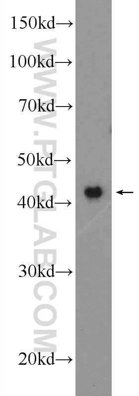 WB analysis of HeLa using 25618-1-AP