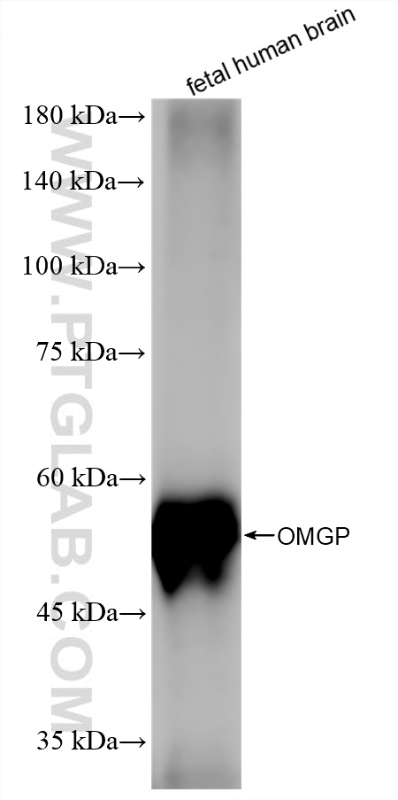 fetal human brain tissue were subjected to SDS PAGE followed by western blot with 86584-1-RR (OMGP antibody) at dilution of 1:2000 incubated at room temperature for 1.5 hours. WB analysis of fetal human brain using 86584-1-RR