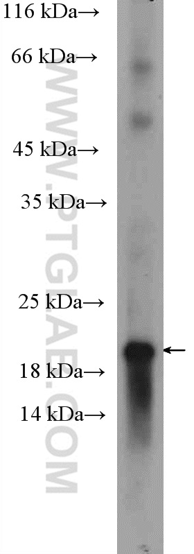 WB analysis of mouse brain using 18185-1-AP