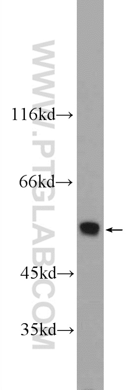 WB analysis of mouse liver using 25137-1-AP